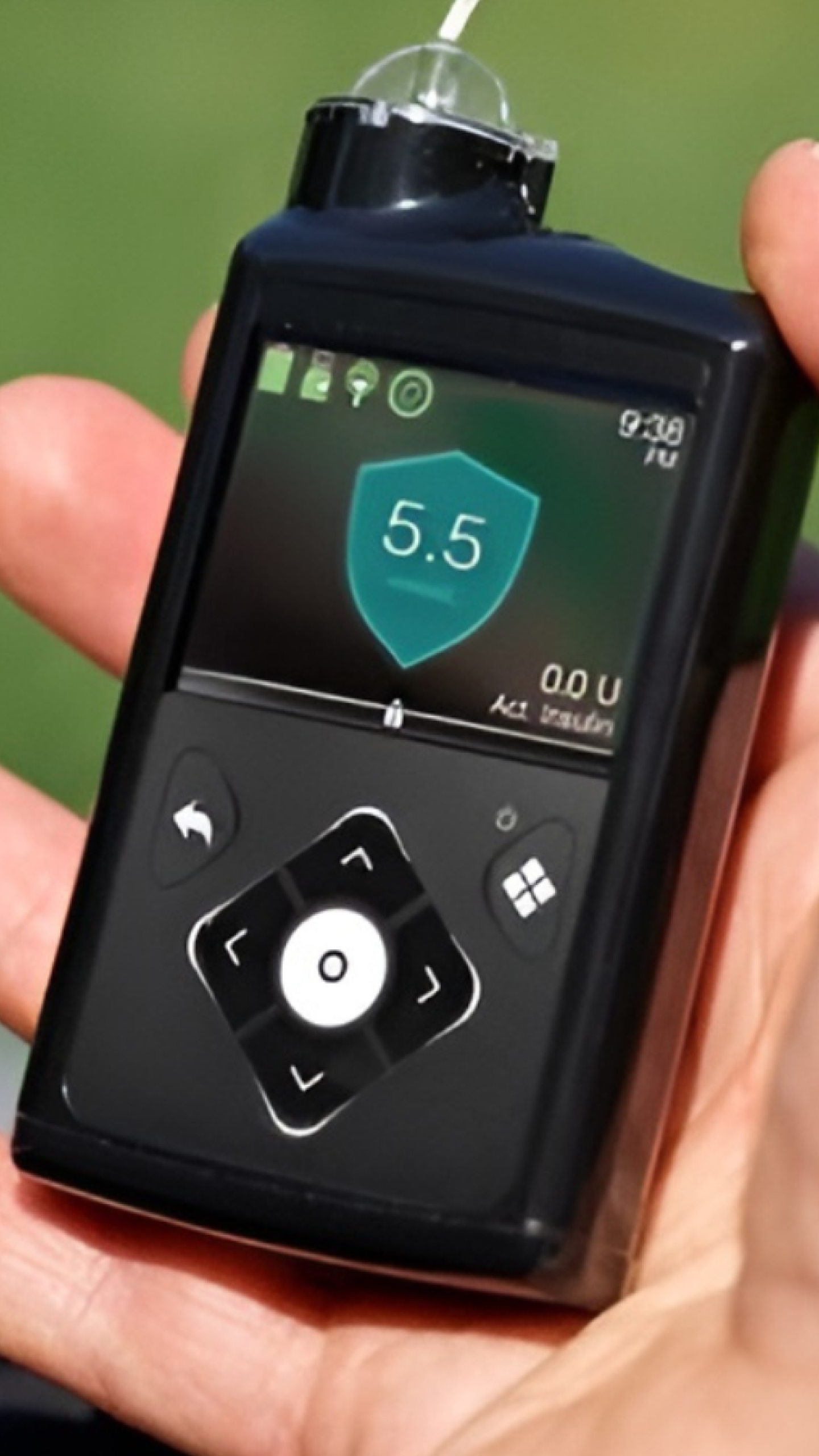 MiniMed Expands Sensor Portfolio in Europe with CE Mark for MiniMed™ 780G System with Instinct Sensor