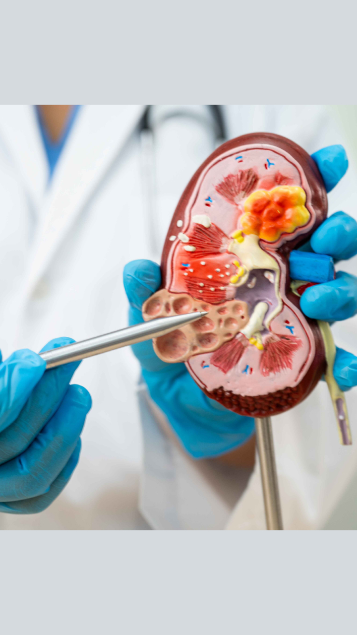 World Kidney Day 2026: Experts Urge Early Screening as Chronic Kidney Disease Affects 1 in 10 People Globally